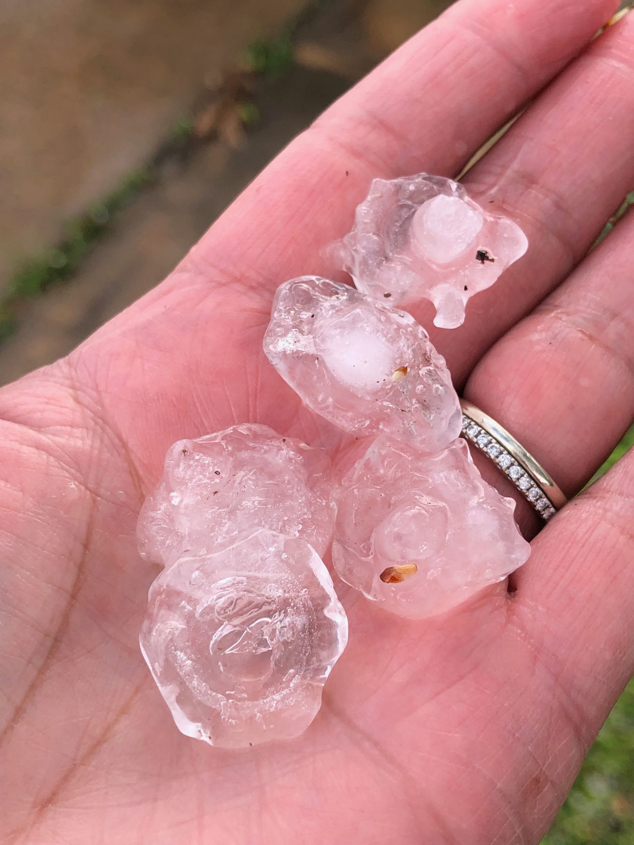 Hail in north Denton